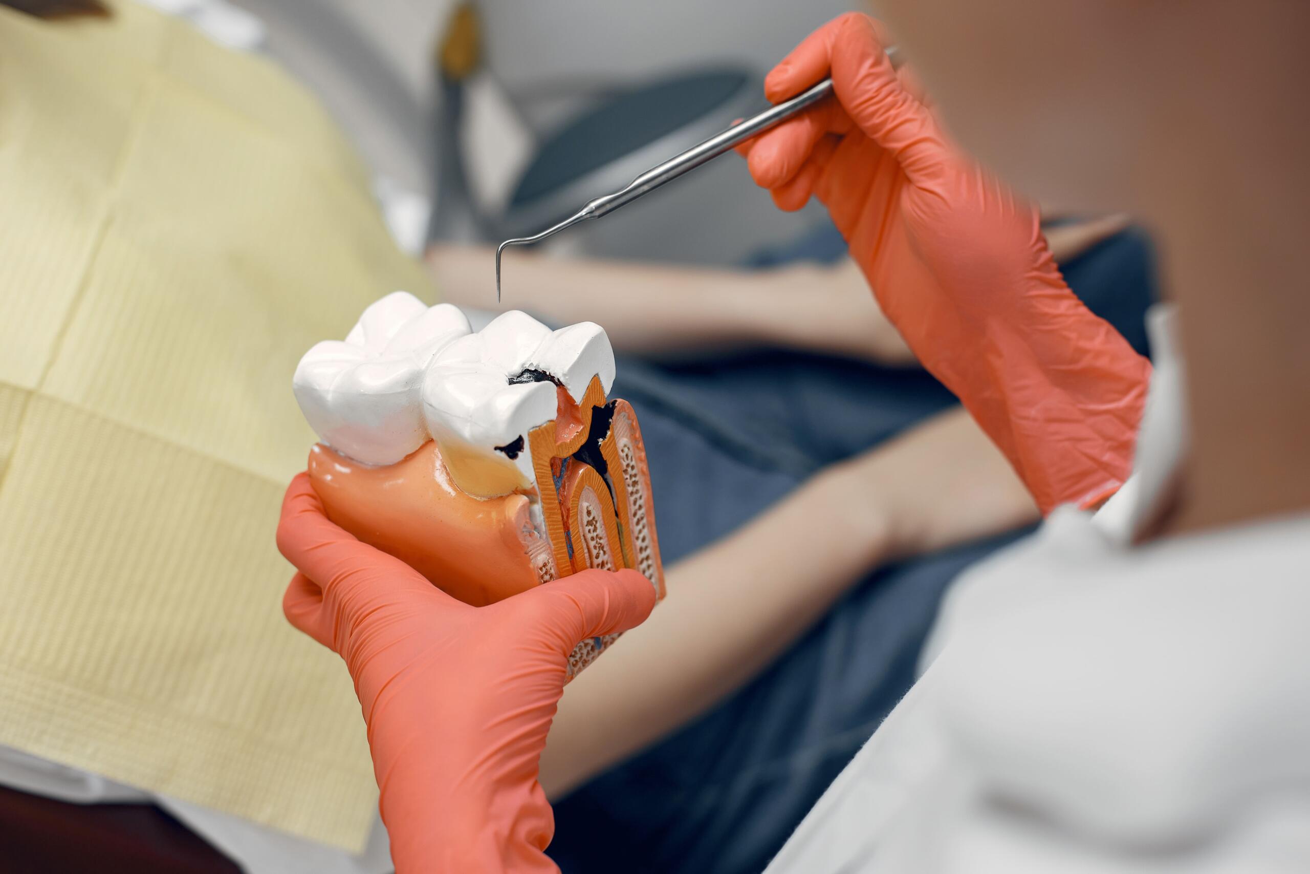 Dental Sealants in Mississauga