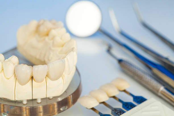 Full Mouth Reconstruction in Mississauga