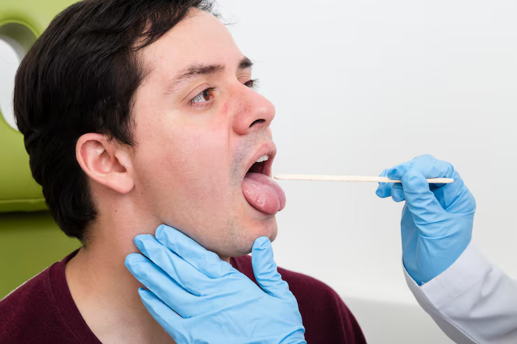 Oral Pathology And Biopsies in Mississauga